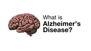 What Is Alzheimer's?