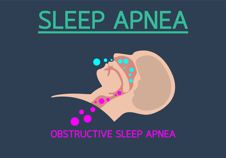 sleep apnea cover