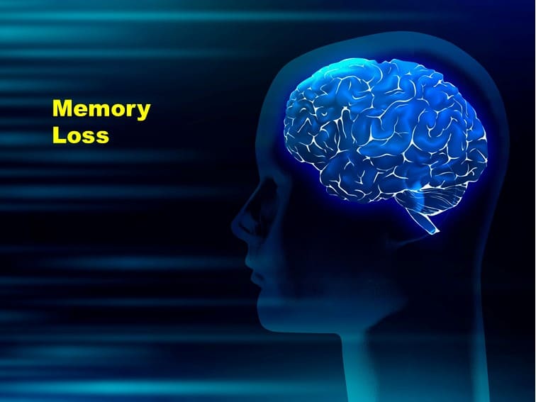 What Causes Memory Loss?