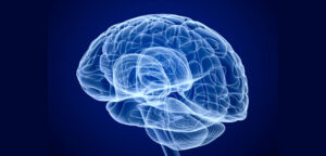 Defining Deep Brain Stimulation