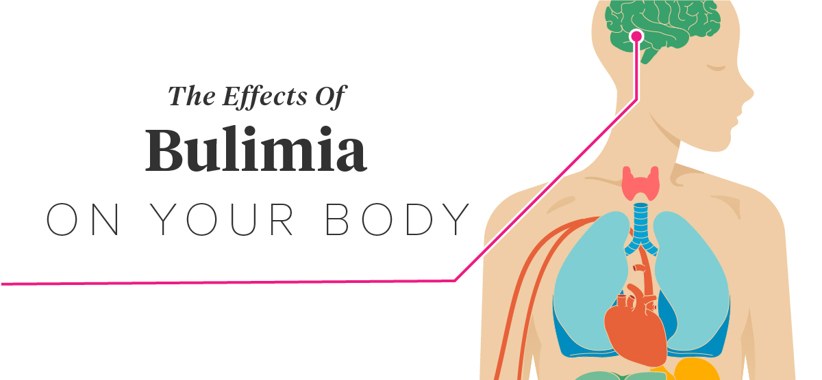 How Does Bulimia Effects, Someone?